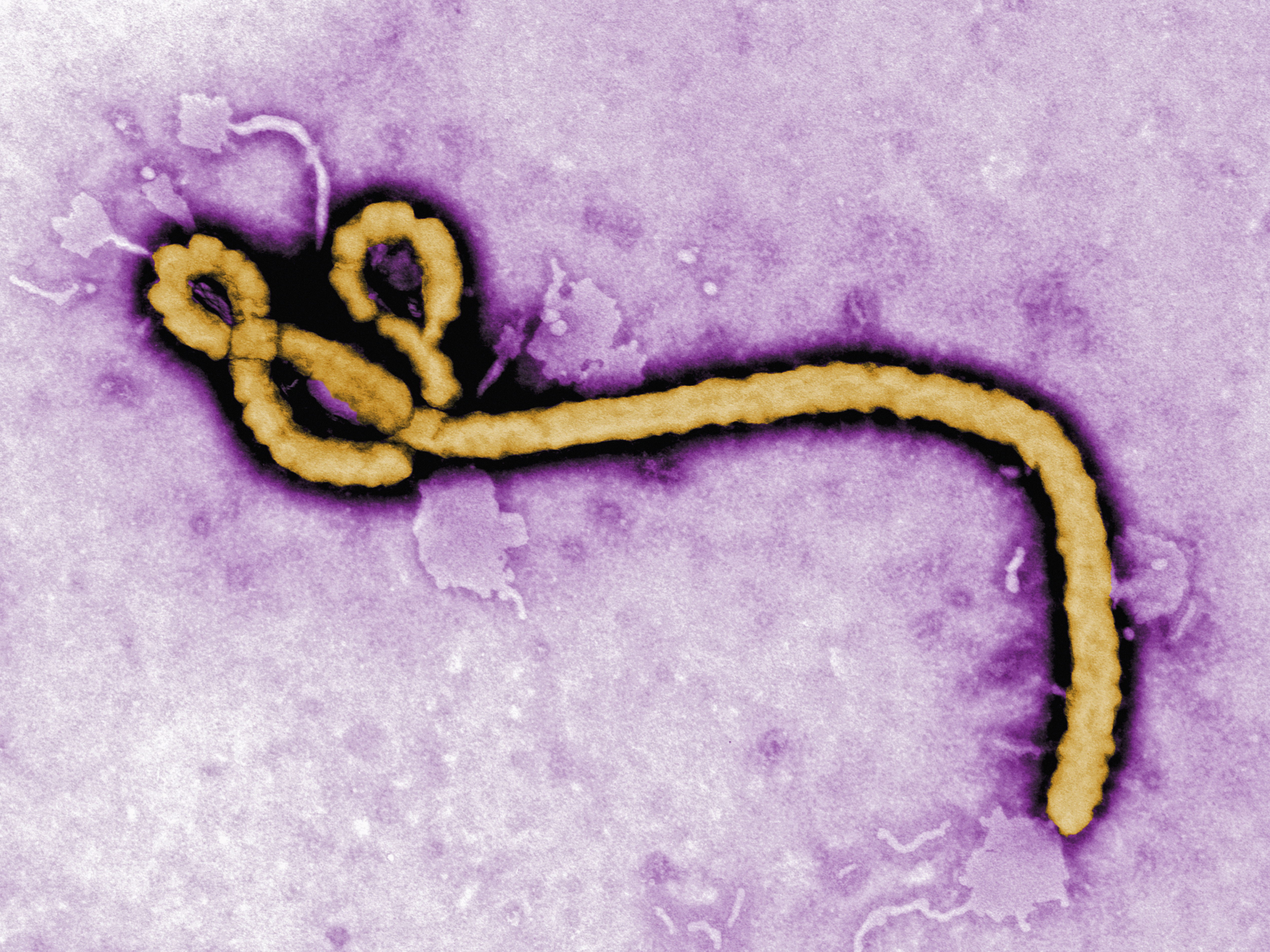 Ebola