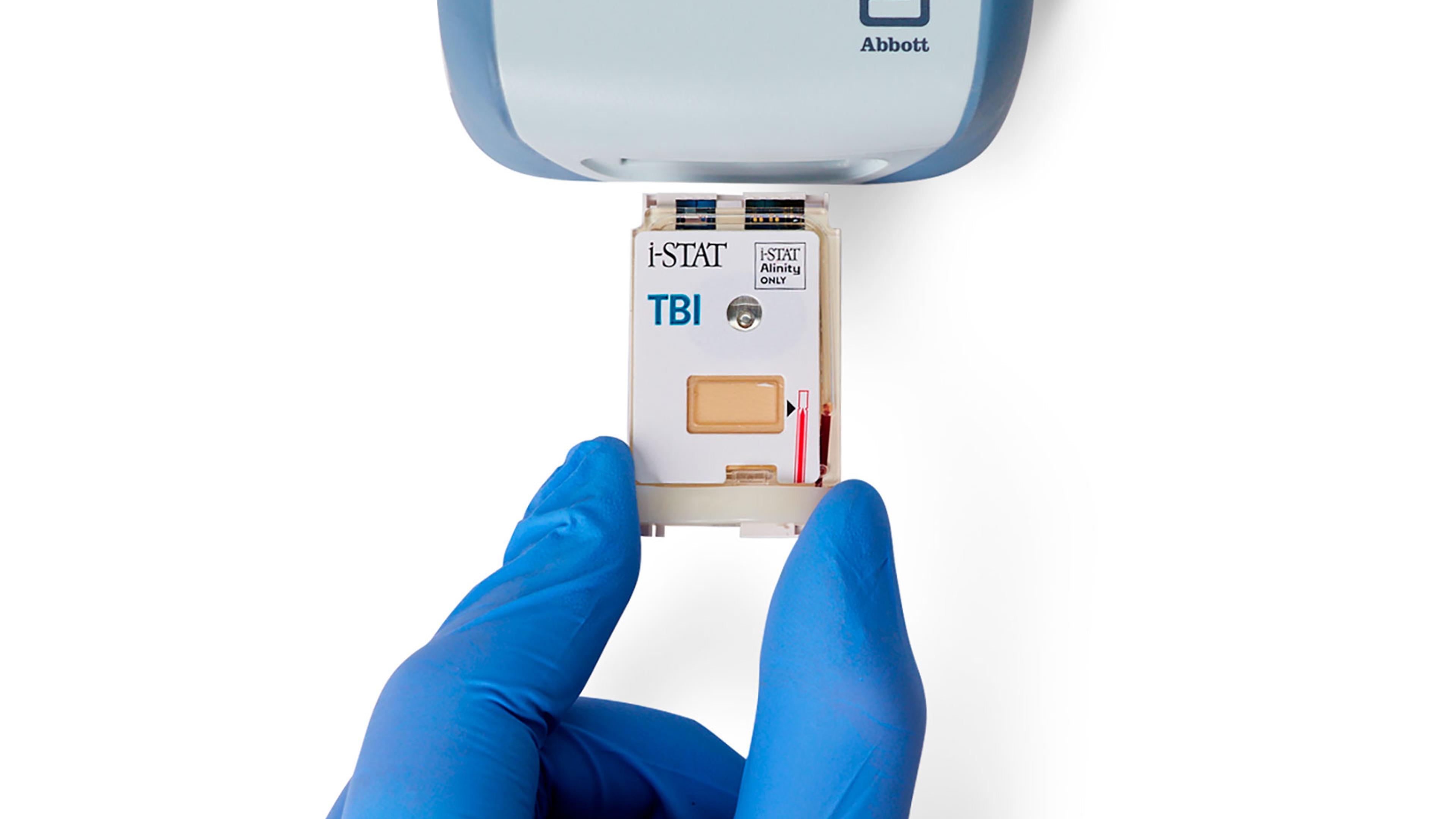 Istat Reader Abbott i-STAT TBI: The Best Inventions of 2025