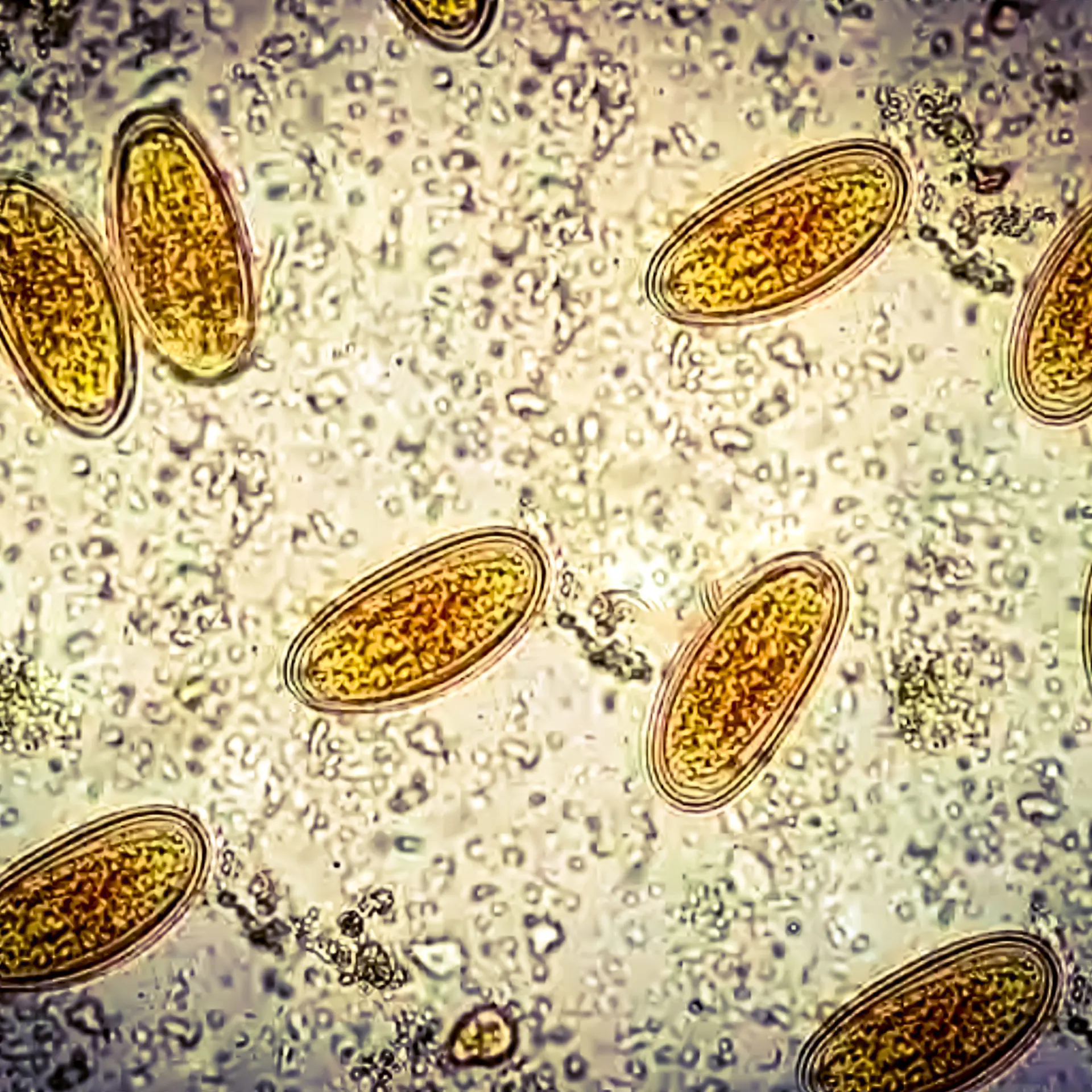 Enterobius vermicularis (EV) eggs. parasite in stool, image under light microscopy 100X objective.