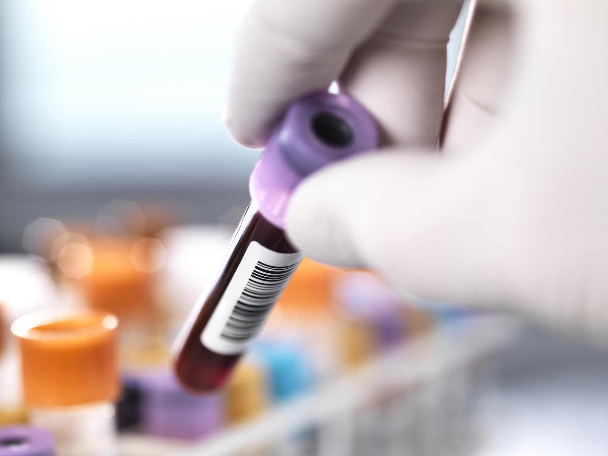 syphilis-blood-test