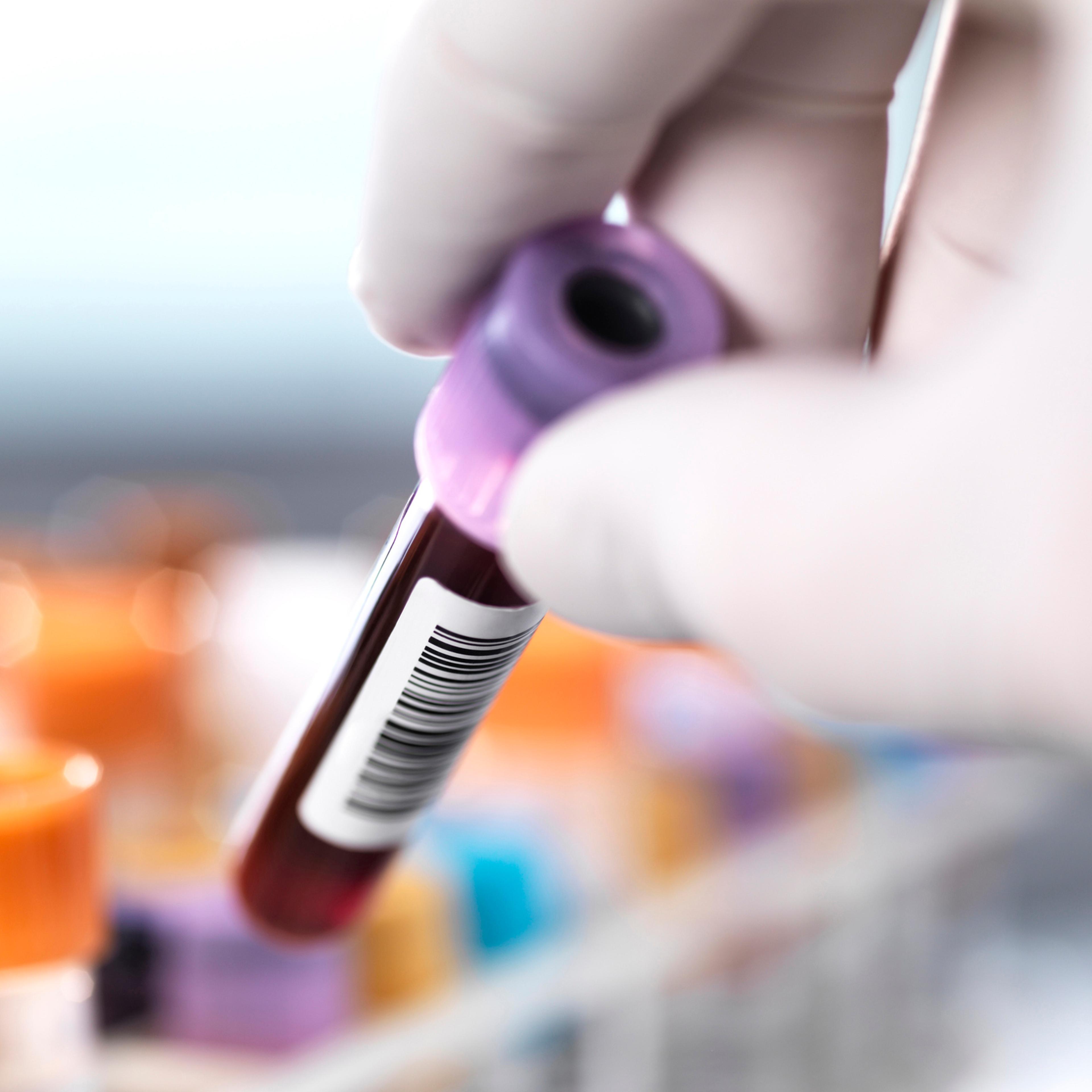 syphilis-blood-test