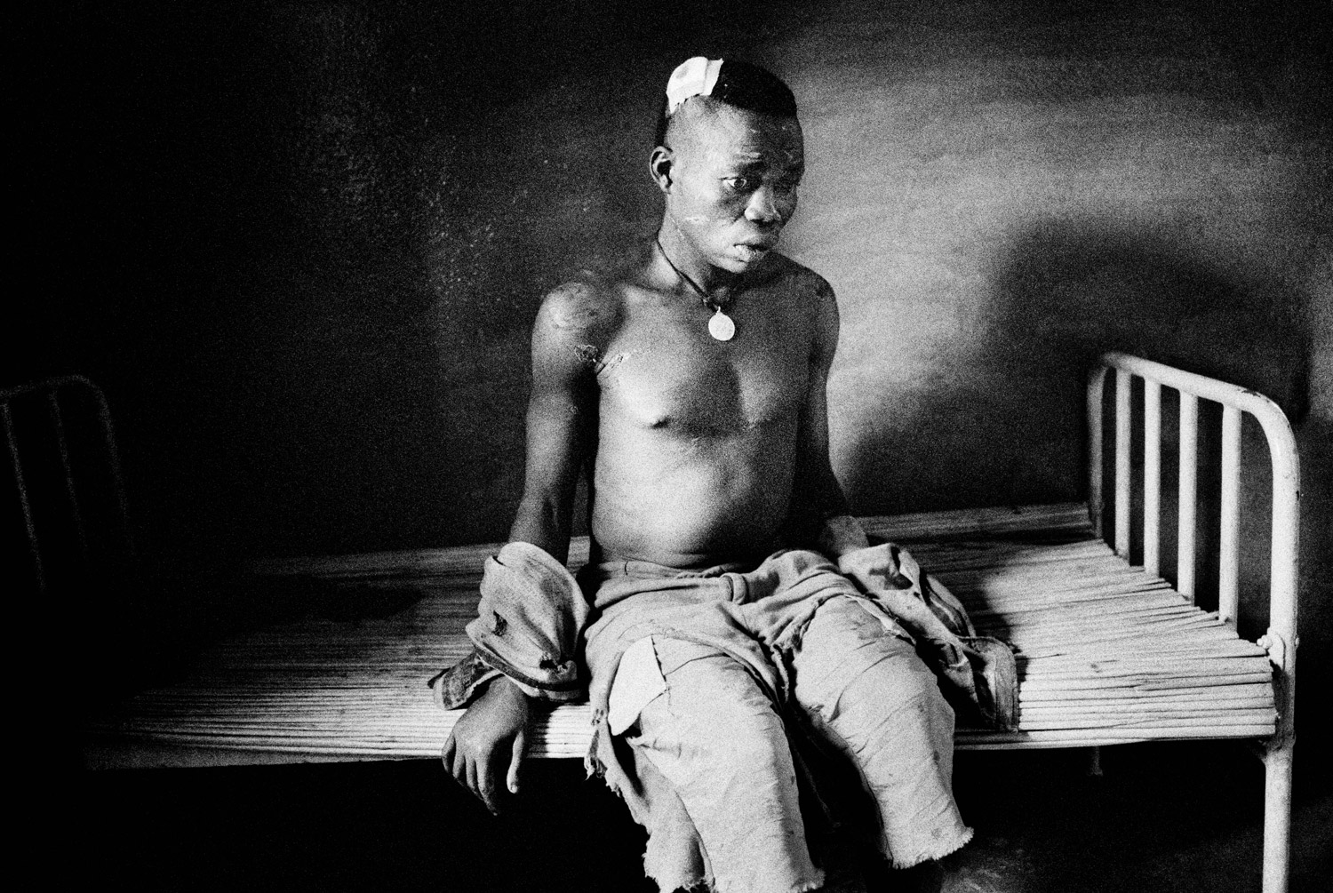 A Lendu soldier, beaten by the local Hema population after being accused of cannibalism, awaits his fate in a makeshift hospital in Drodro, Democratic Republic of Congo, August 2003. The ongoing conflict and lack of medical care has claimed the lives of millions of people in the DRC since 1998.