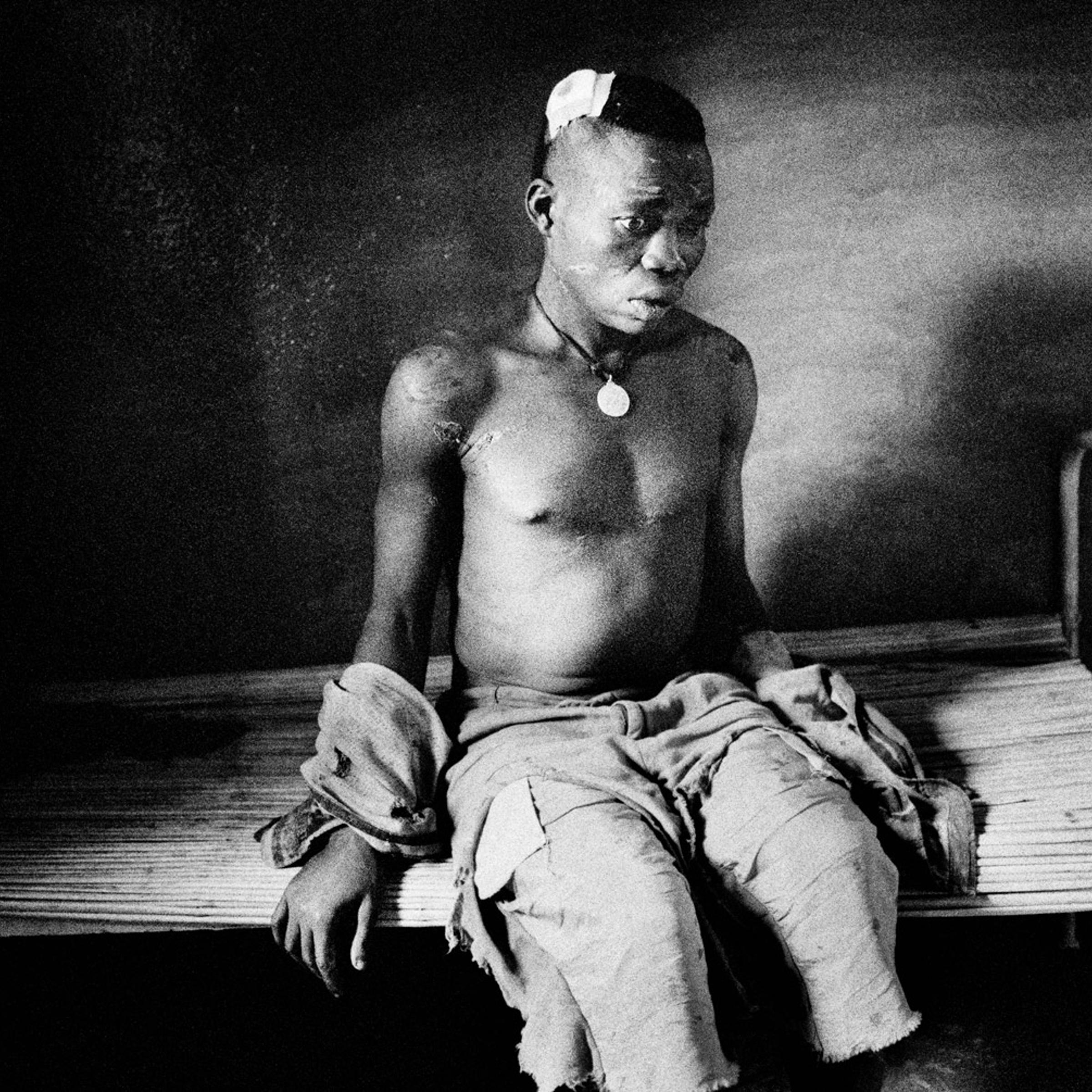 A Lendu soldier, beaten by the local Hema population after being accused of cannibalism, awaits his fate in a makeshift hospital in Drodro, Democratic Republic of Congo, August 2003. The ongoing conflict and lack of medical care has claimed the lives of millions of people in the DRC since 1998.