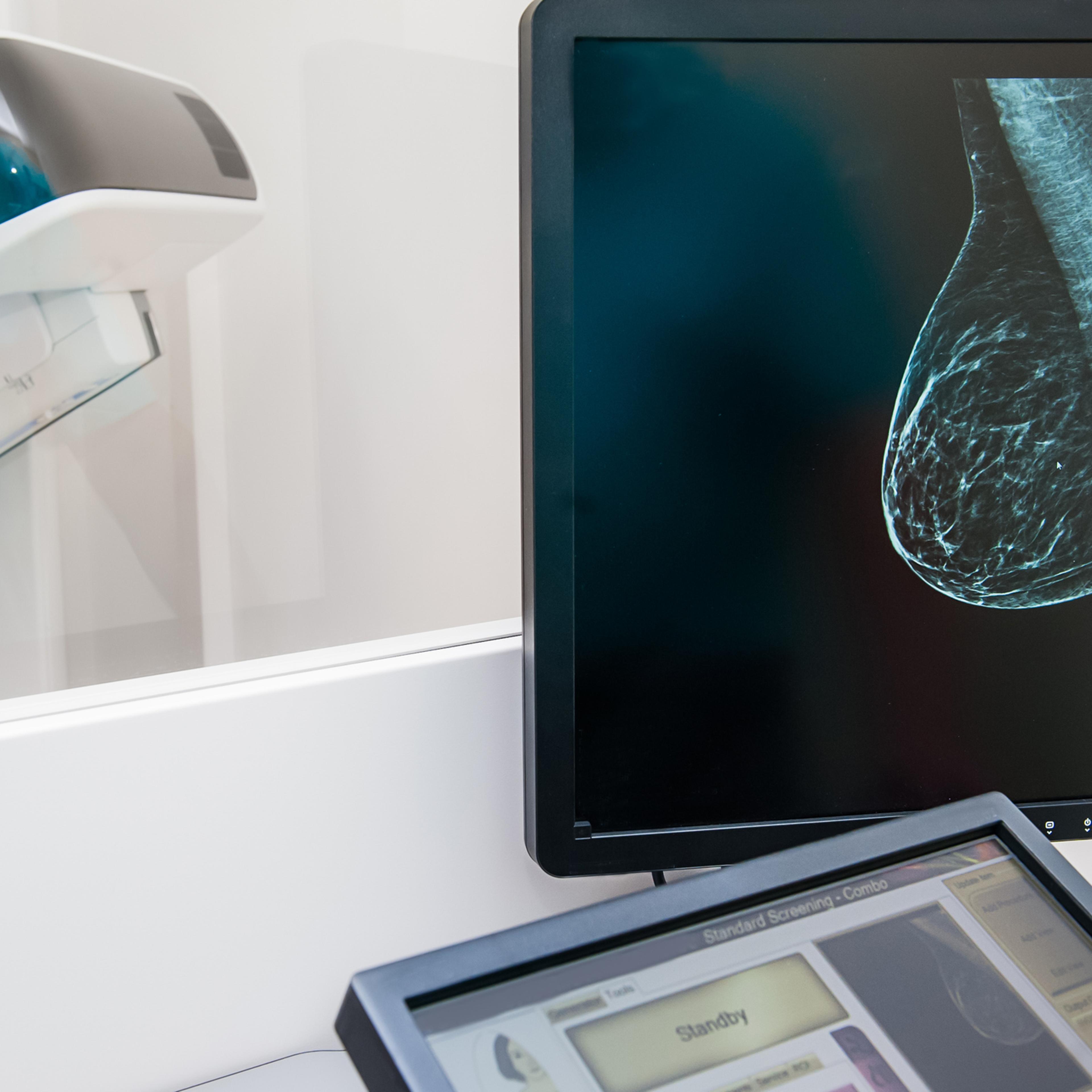 mammogram