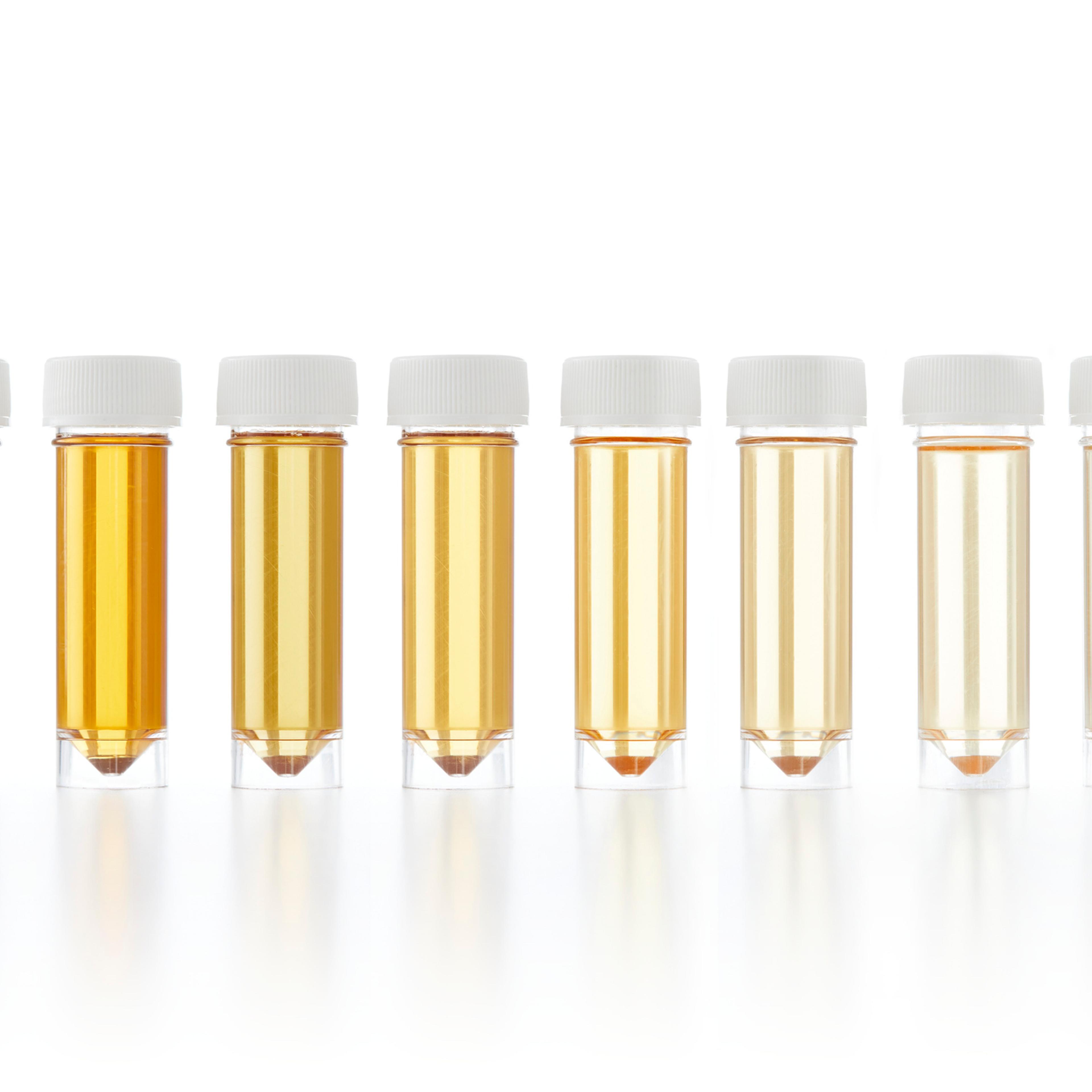 Urine samples for analysis