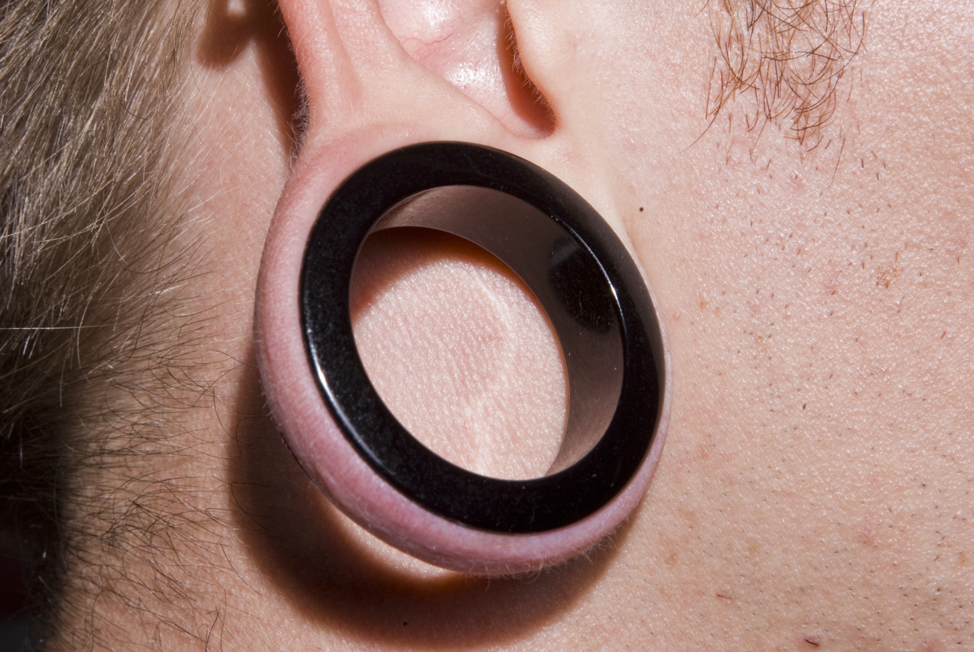 Fixing Earlobe Holes Made by Disc Earrings Can Cost Thousands of Dollars