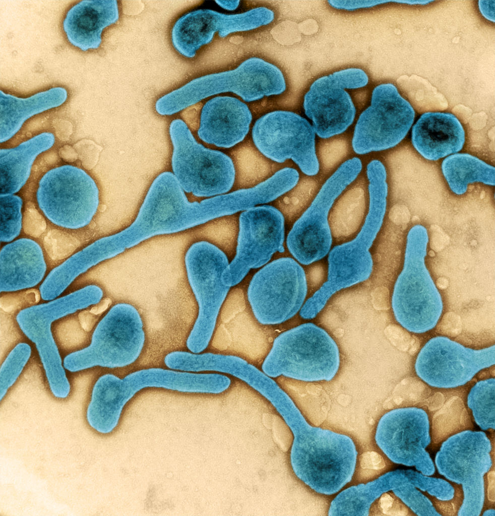 Marburg-virus-particles