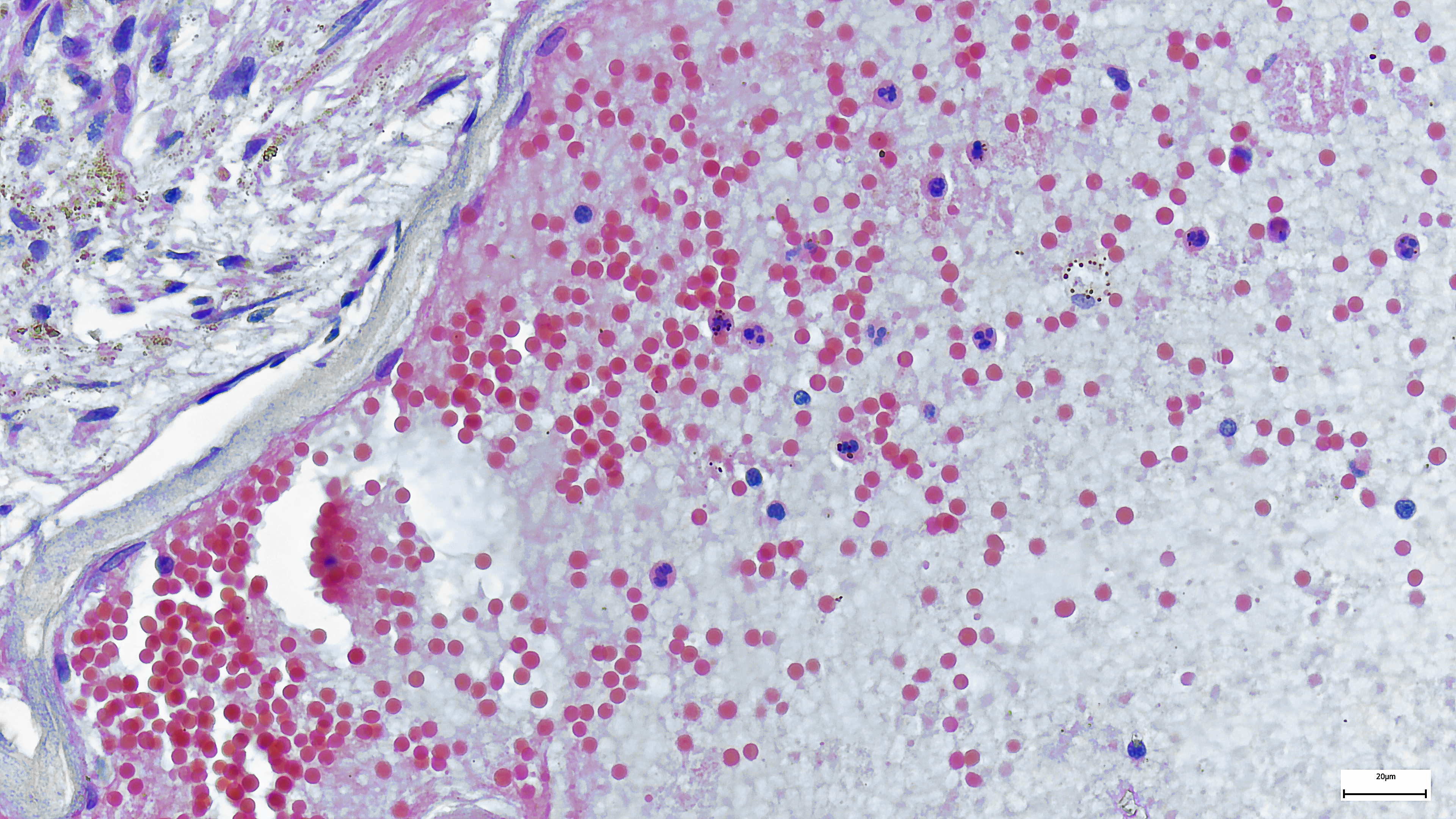 monkeypox-virus