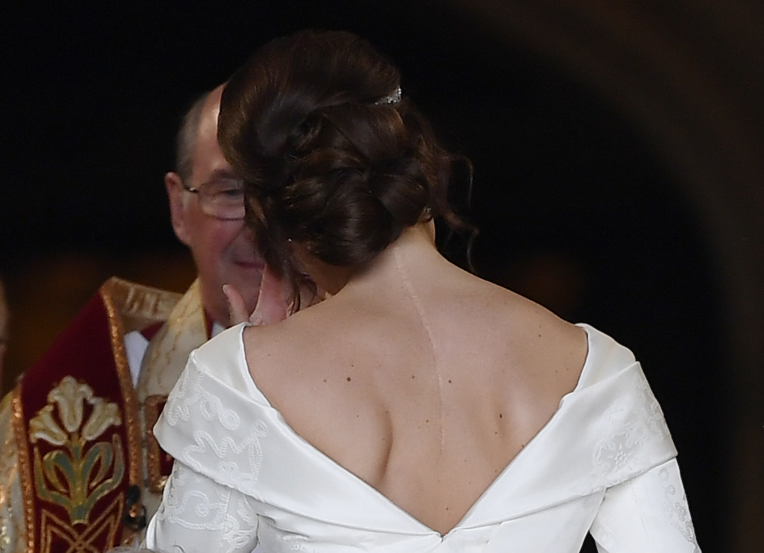 Princess Eugenie Wore Wedding Dress That Showed Scoliosis Scars