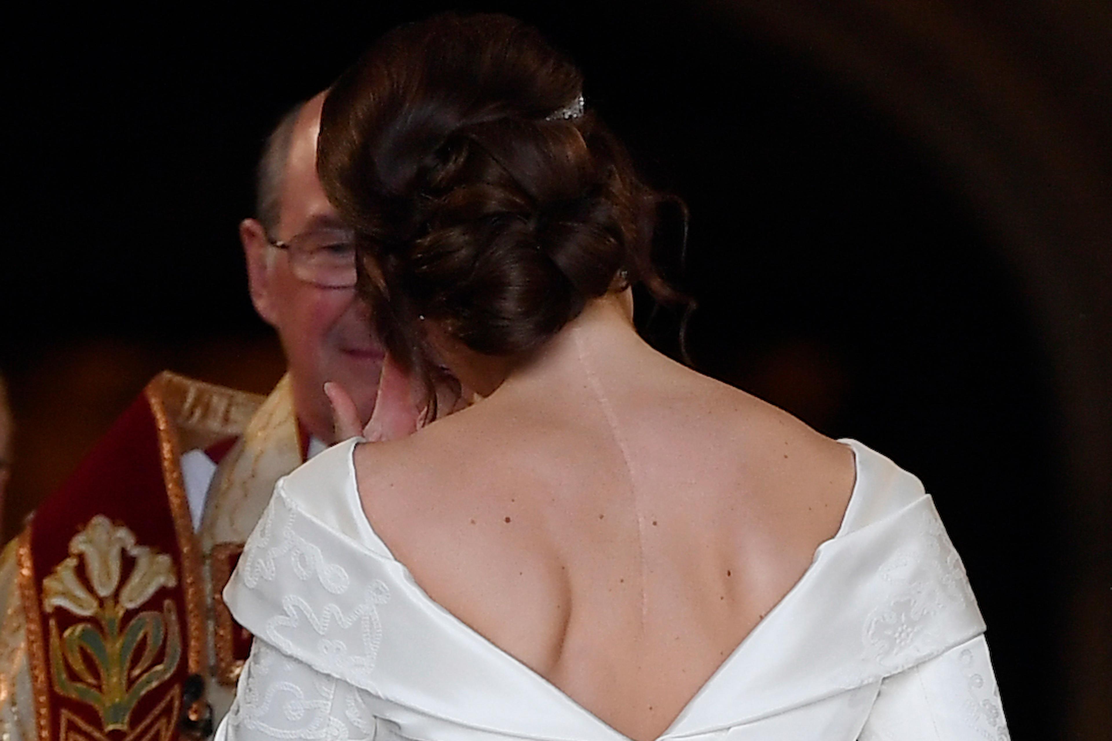 Princess Eugenie Wore Wedding Dress That Showed Scoliosis Scars Princess Eugenie Wore Wedding Dress That Showed Scoliosis Scars