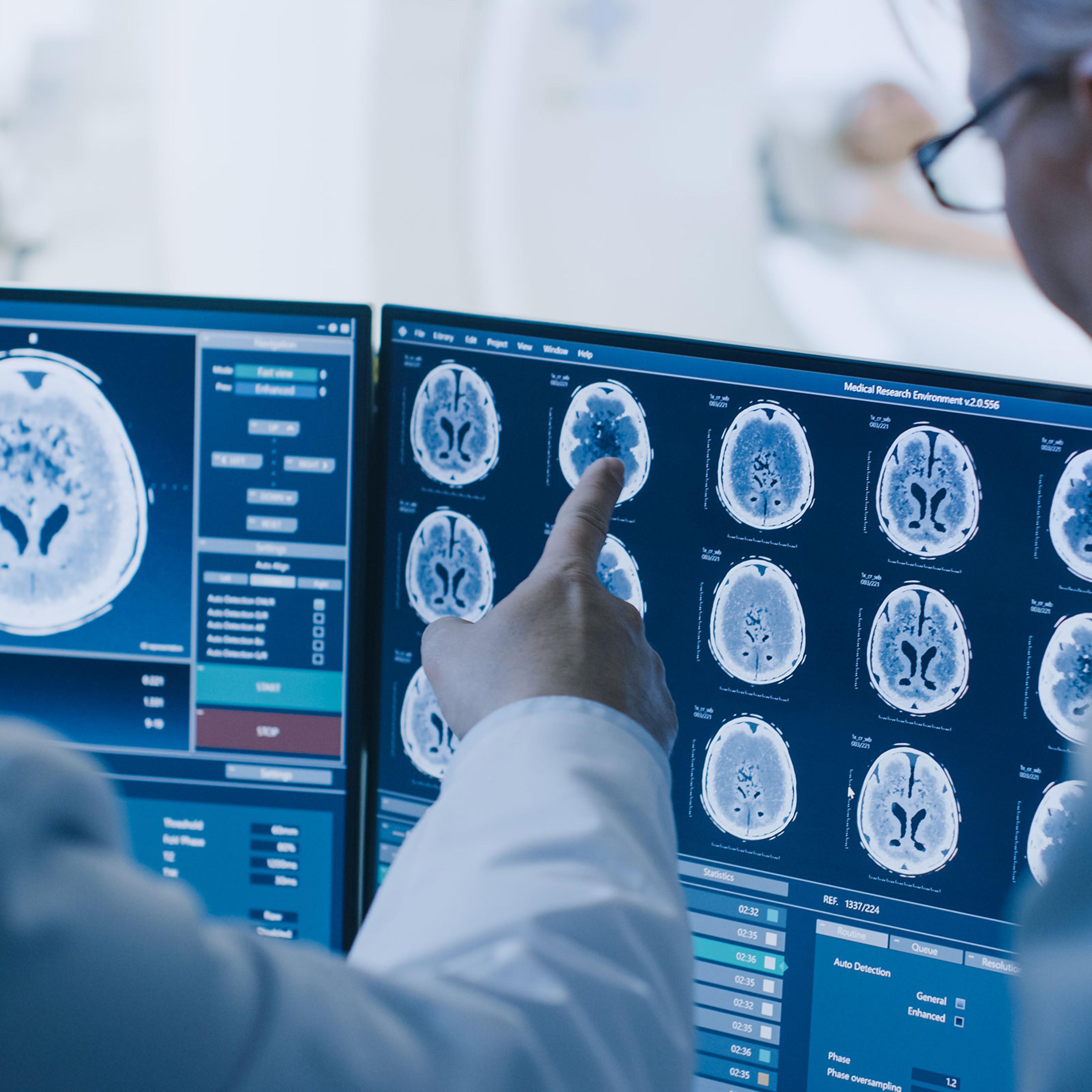 In Control Room Doctor and Radiologist Discuss Diagnosis while Watching Procedure and Monitors Showing Brain Scans Results, In the Background Patient Undergoes MRI or CT Scan Procedure.