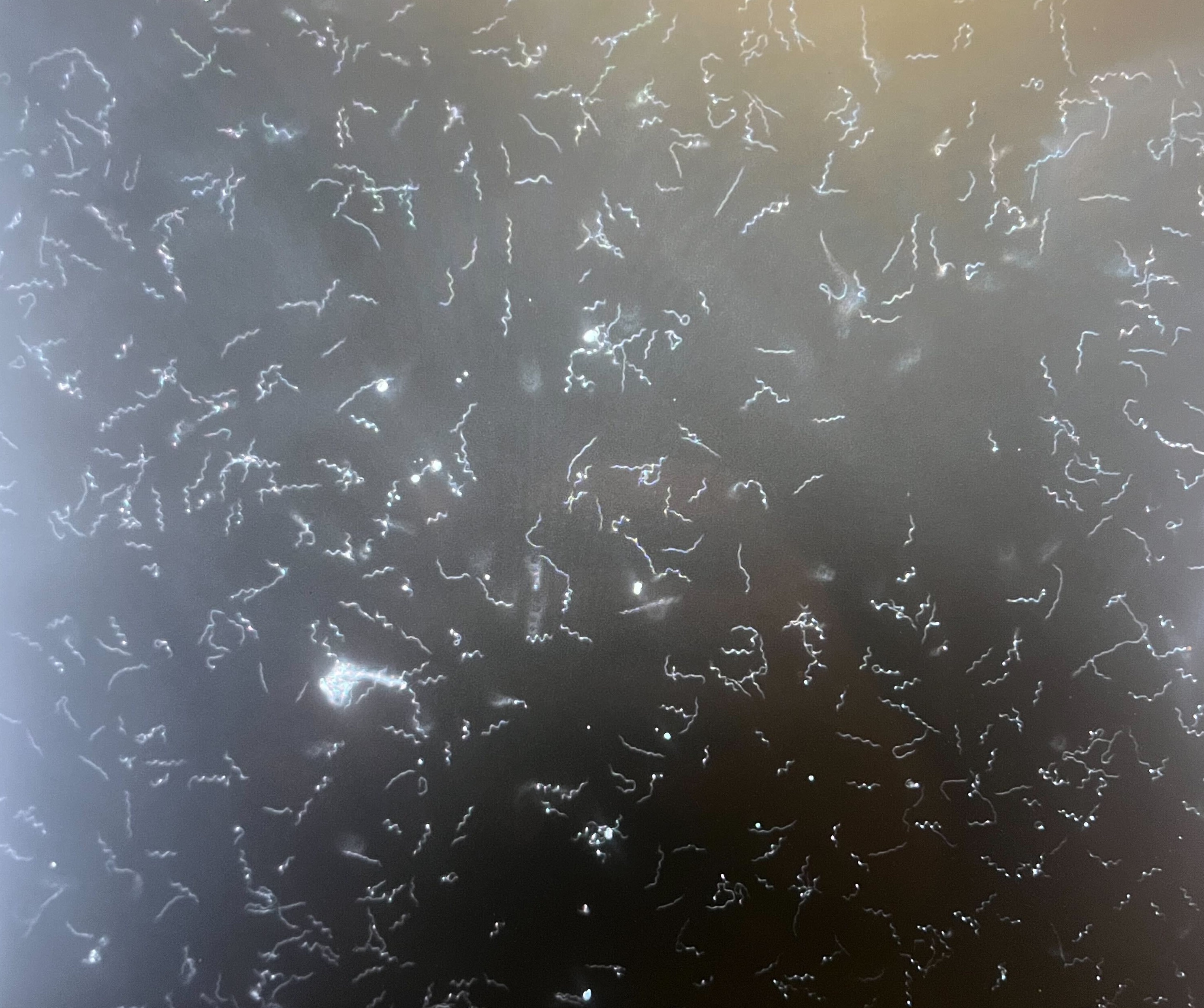 Borrelia burgdorferi