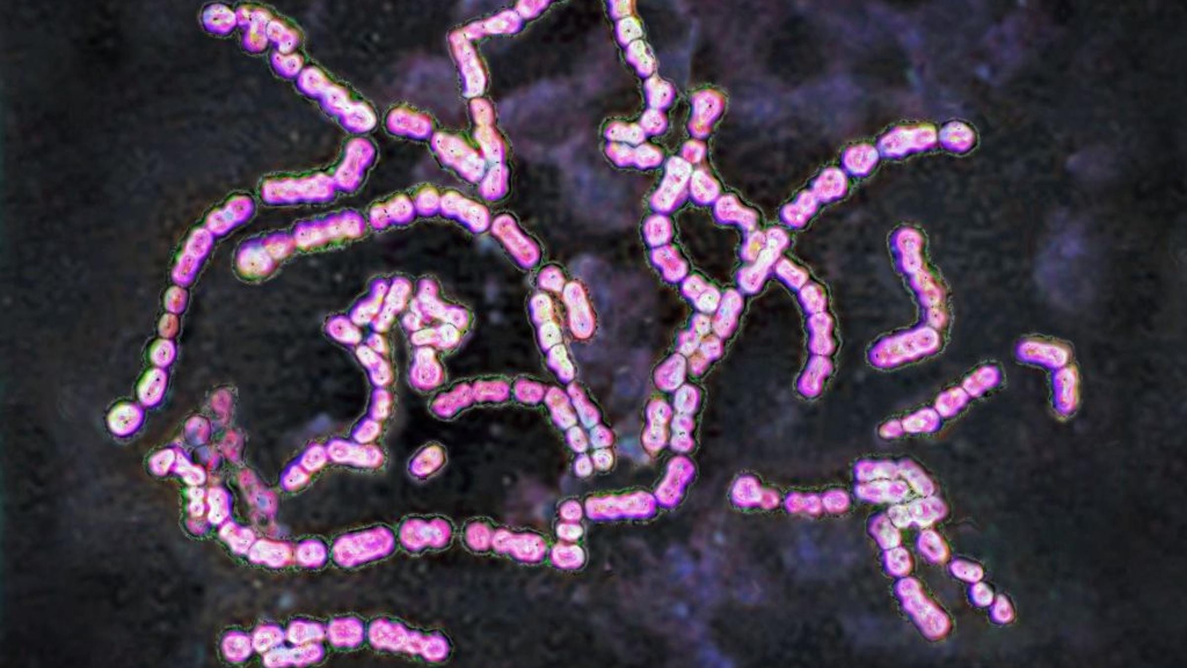 Stack Infection Invasive Strep Infections Are Rising in the U.S.
