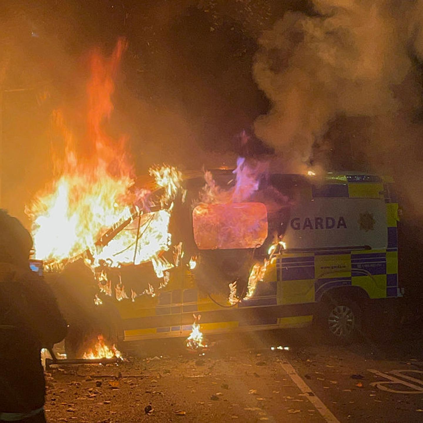 IRELAND-DEMONSTRATION-ASSAULT-POLICE-MIGRATION