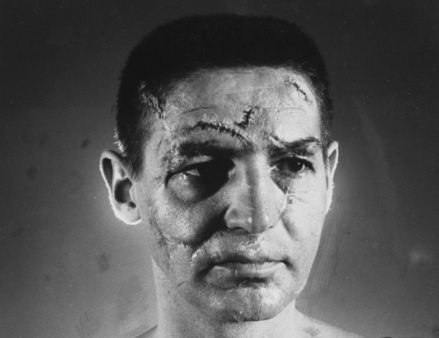 Goalie Terry Sawchuk sports fake scars and wounds applied by a make-up artist to simulate injuries accumulated in 16 years of professional hockey, 1966.