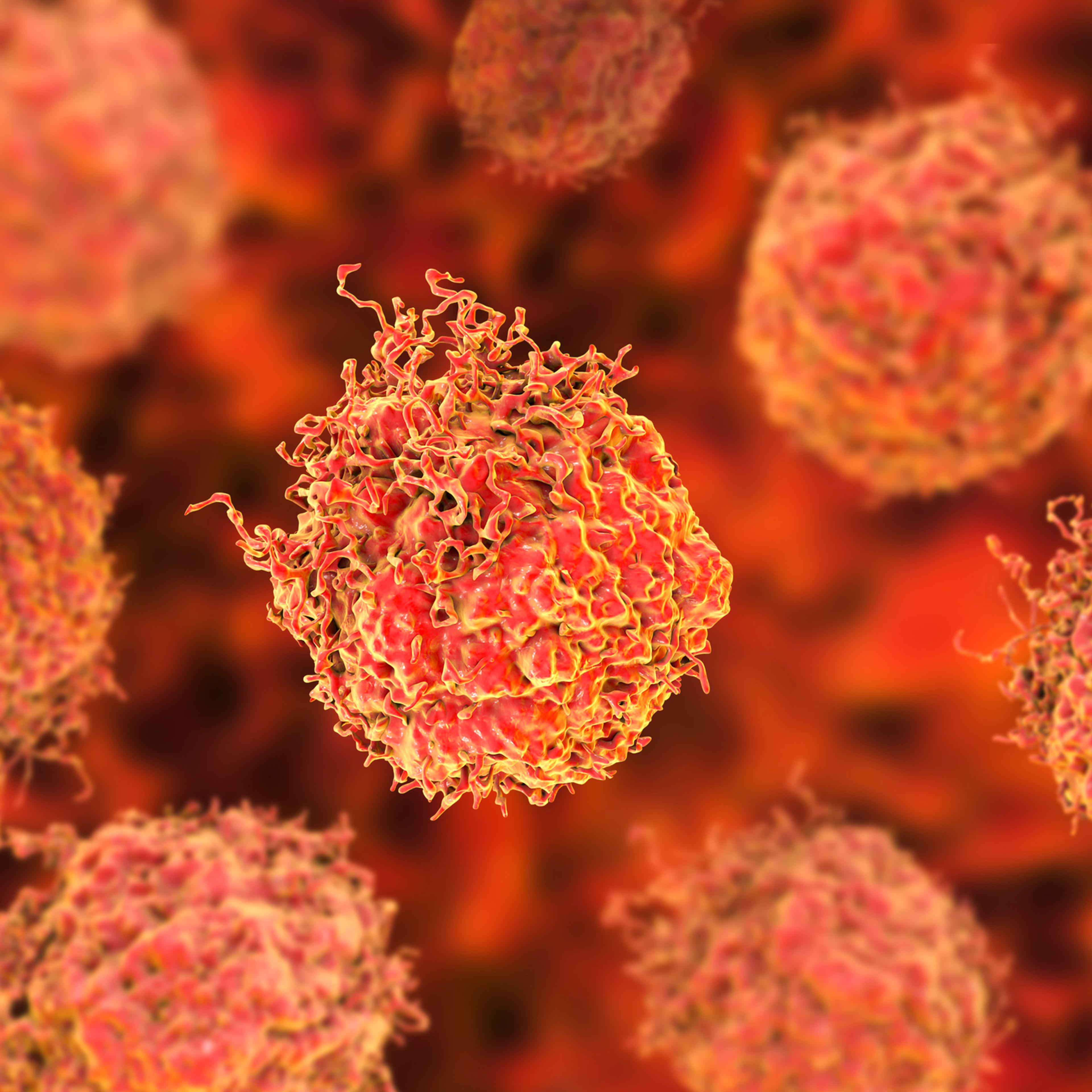 Prostate cancer cells