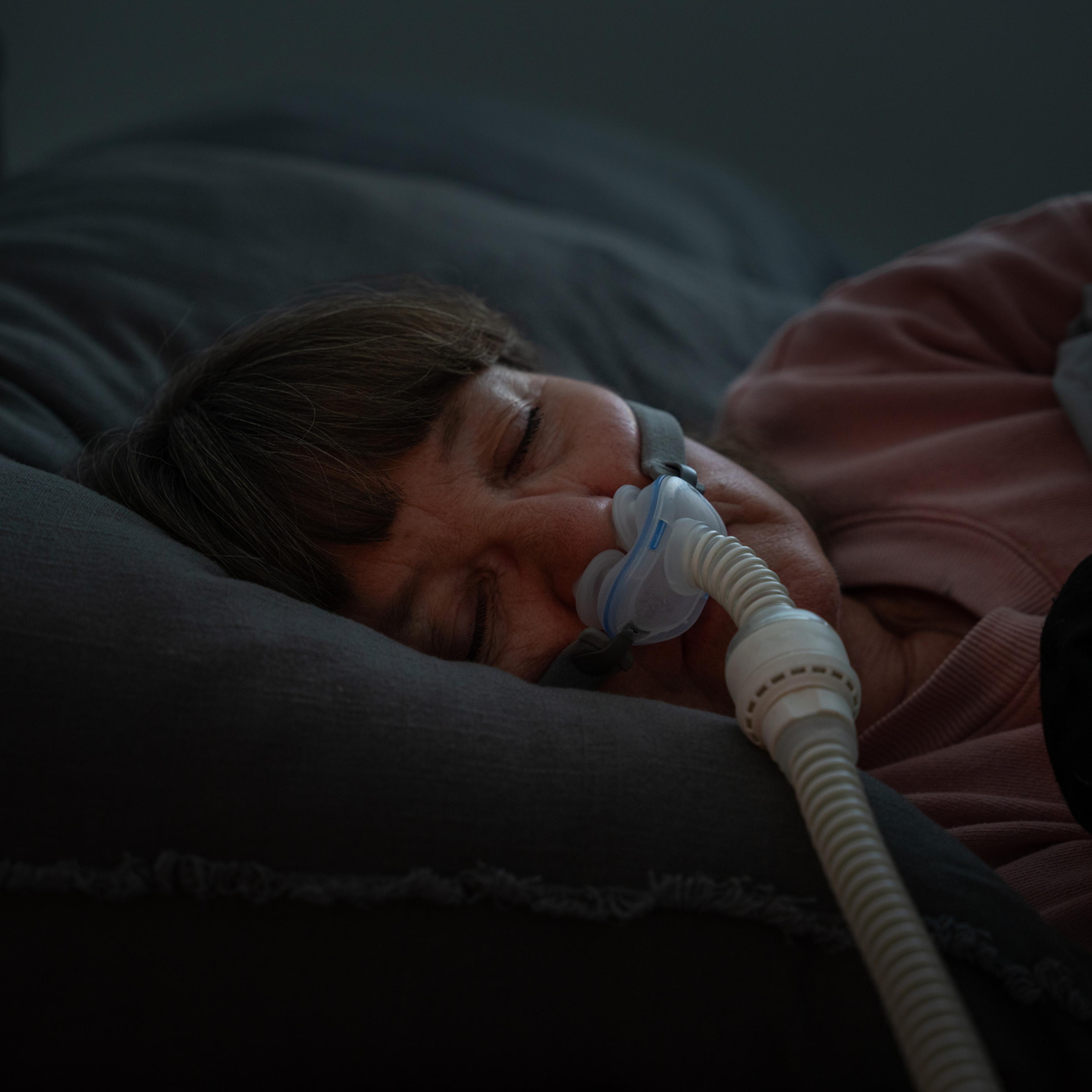 Rising temperatures may make sleep apnea worse, researchers say.