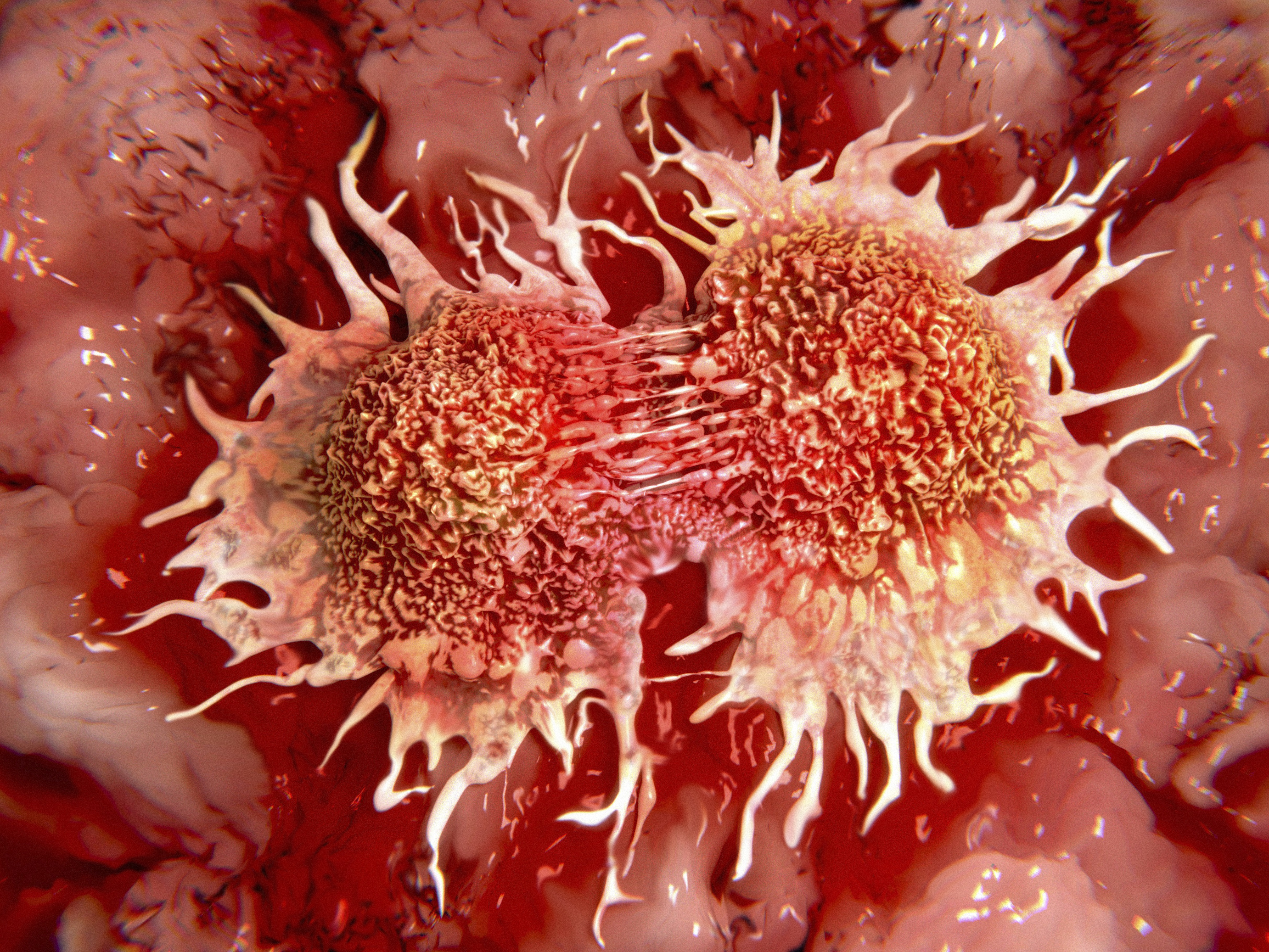 Cancer | TIME