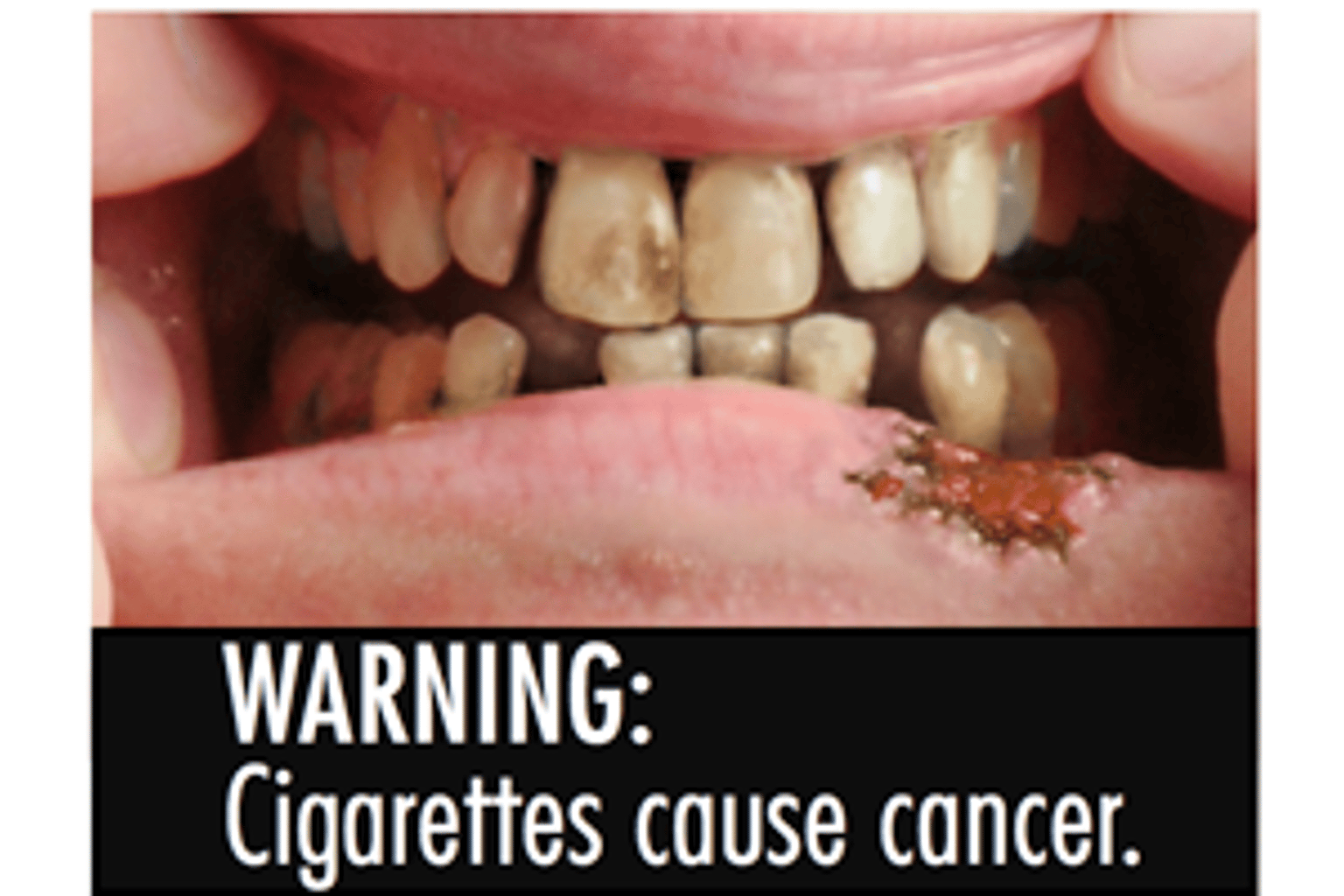what is the effect of smoking cigarettes The Effects of Smoking what is the effect of smoking cigarettes The Effects of Smoking