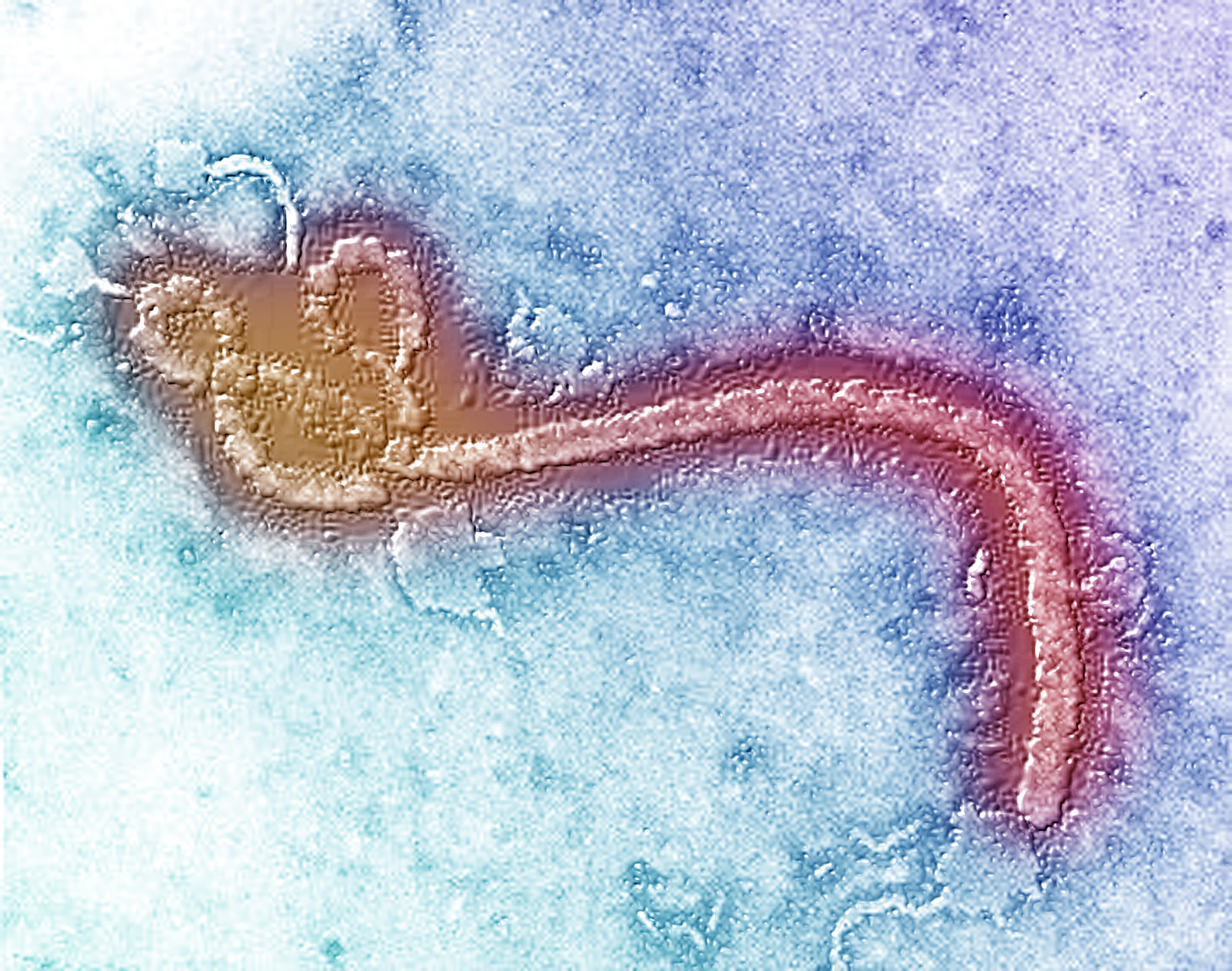 We Now Know More About Sexually Transmitted Ebola