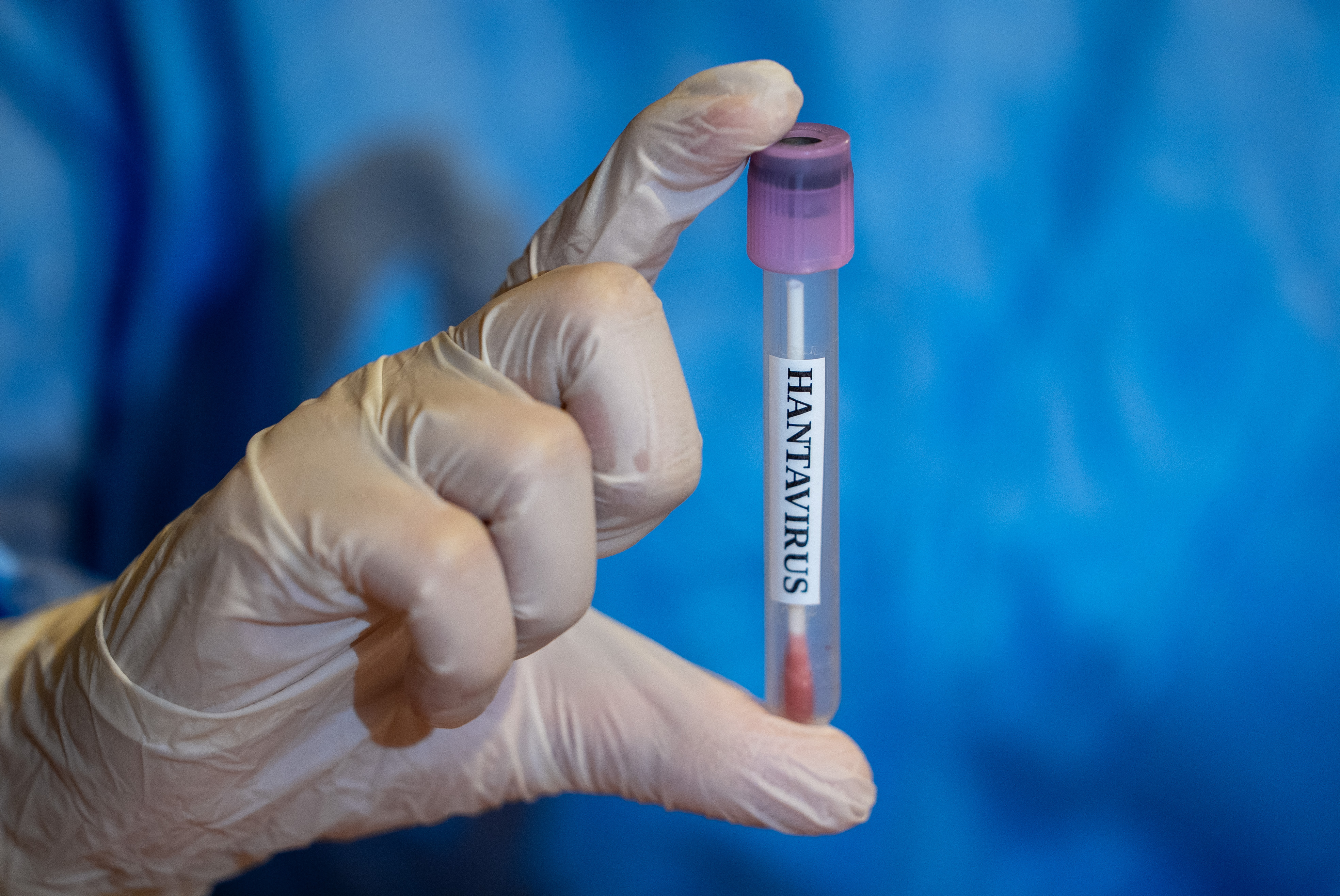 Several U.S. States Monitoring Cruise Passengers as Latest Hantavirus Case Reported