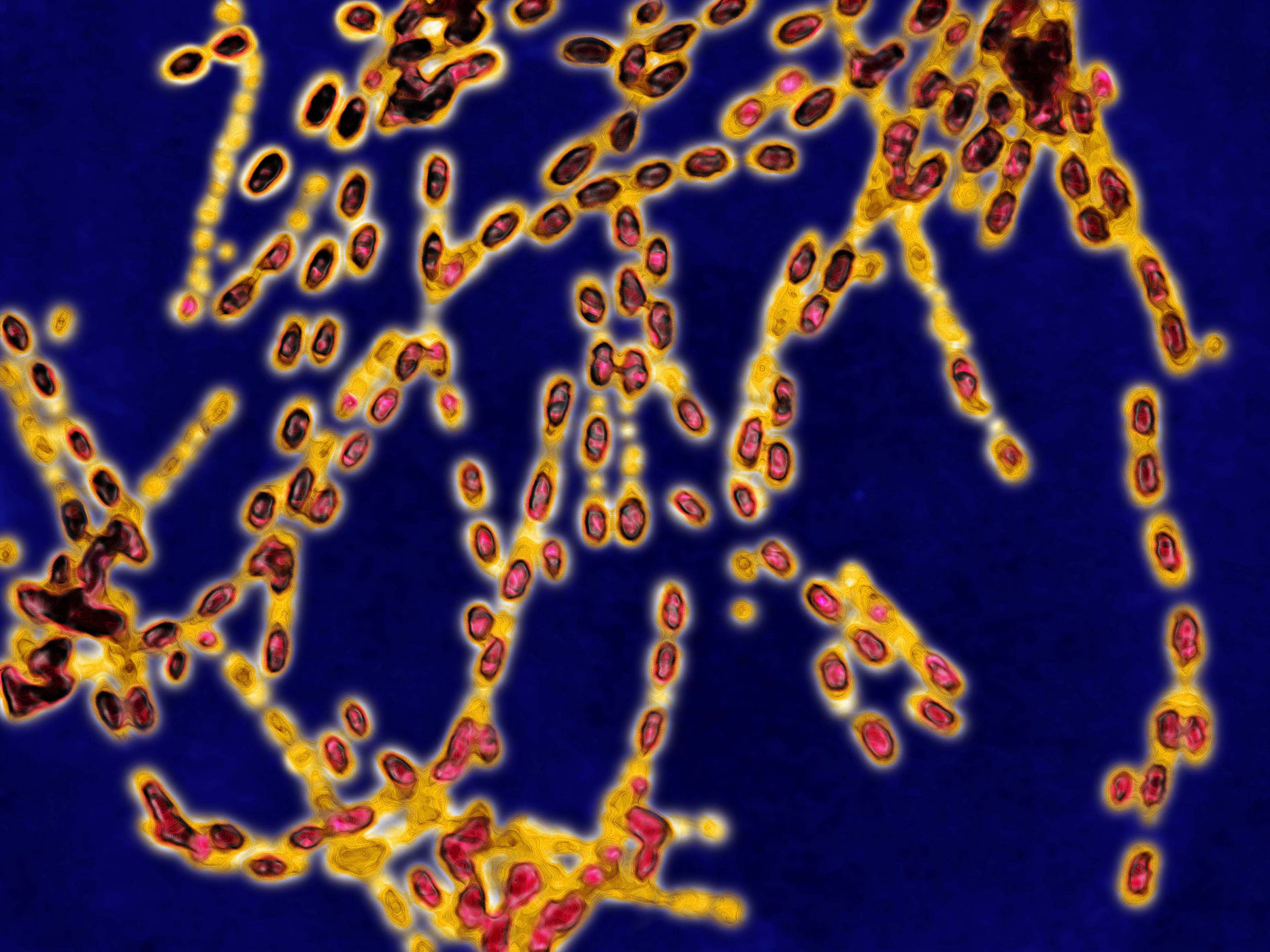 Pentagon: U.S. Army sent live Anthrax sample to UK