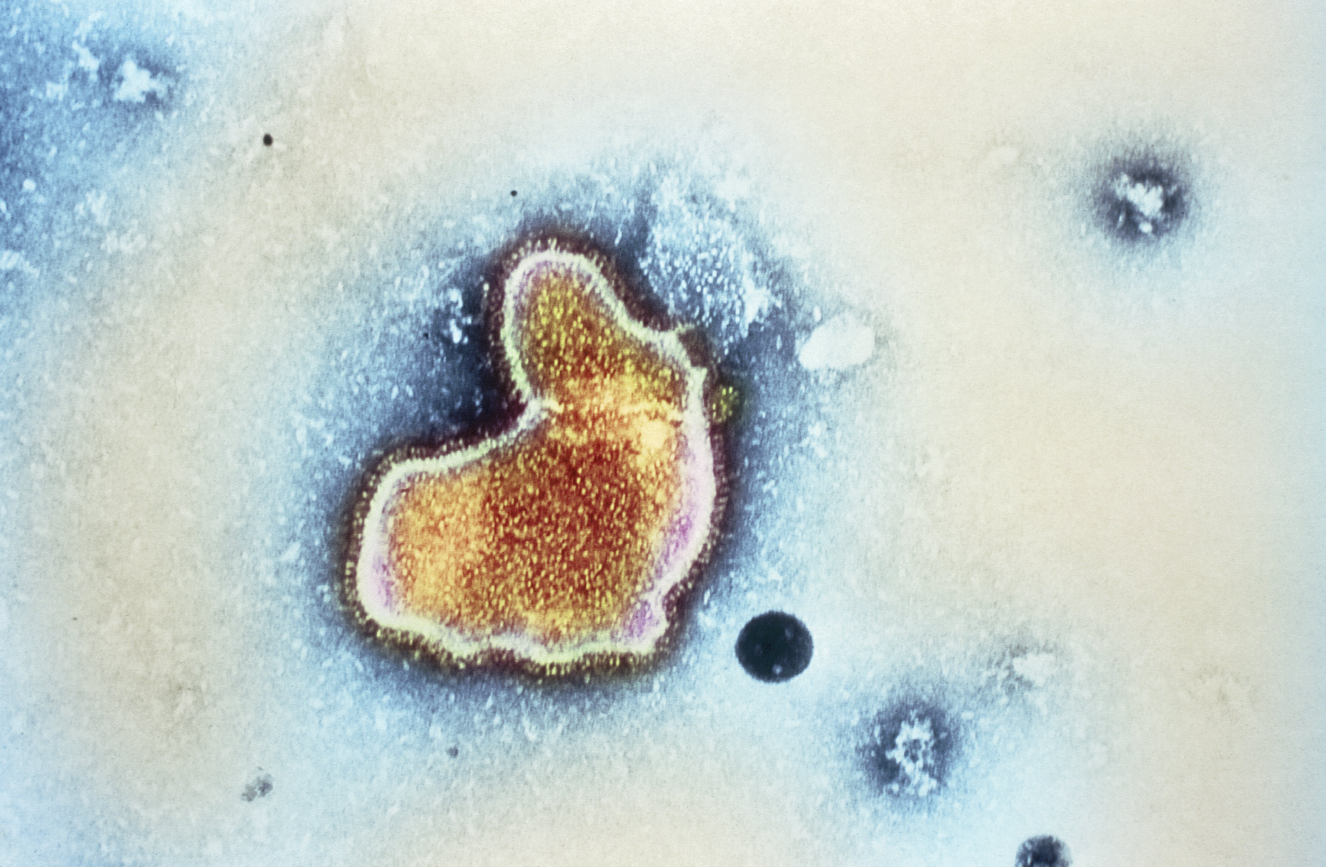 Respiratory syncytial virus