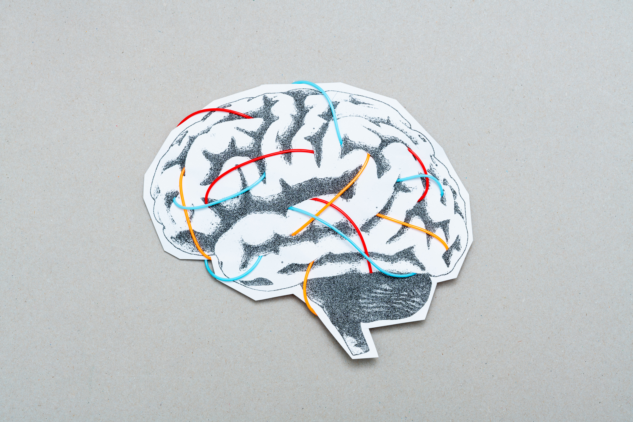 The Brain Processes Language Even Under Anesthesia, a New Study Finds