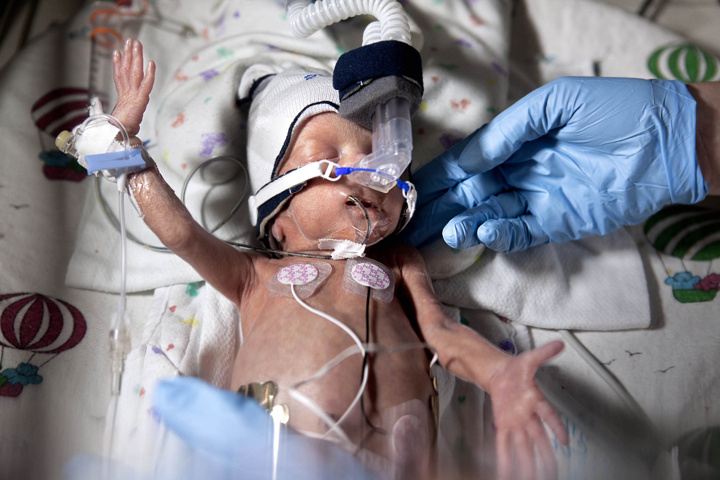 Level IV Preemie Care