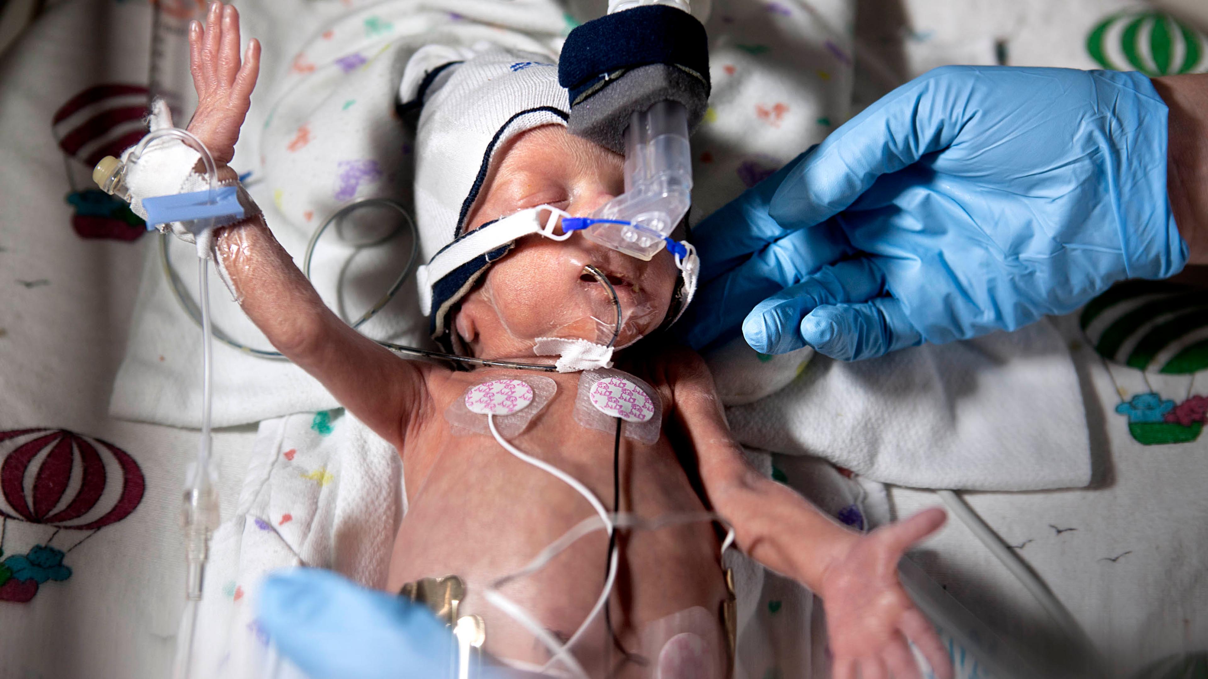 Level IV Preemie Care