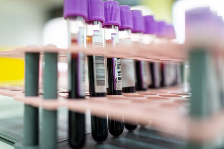 96% of Americans Have Some COVID-19 Immunity