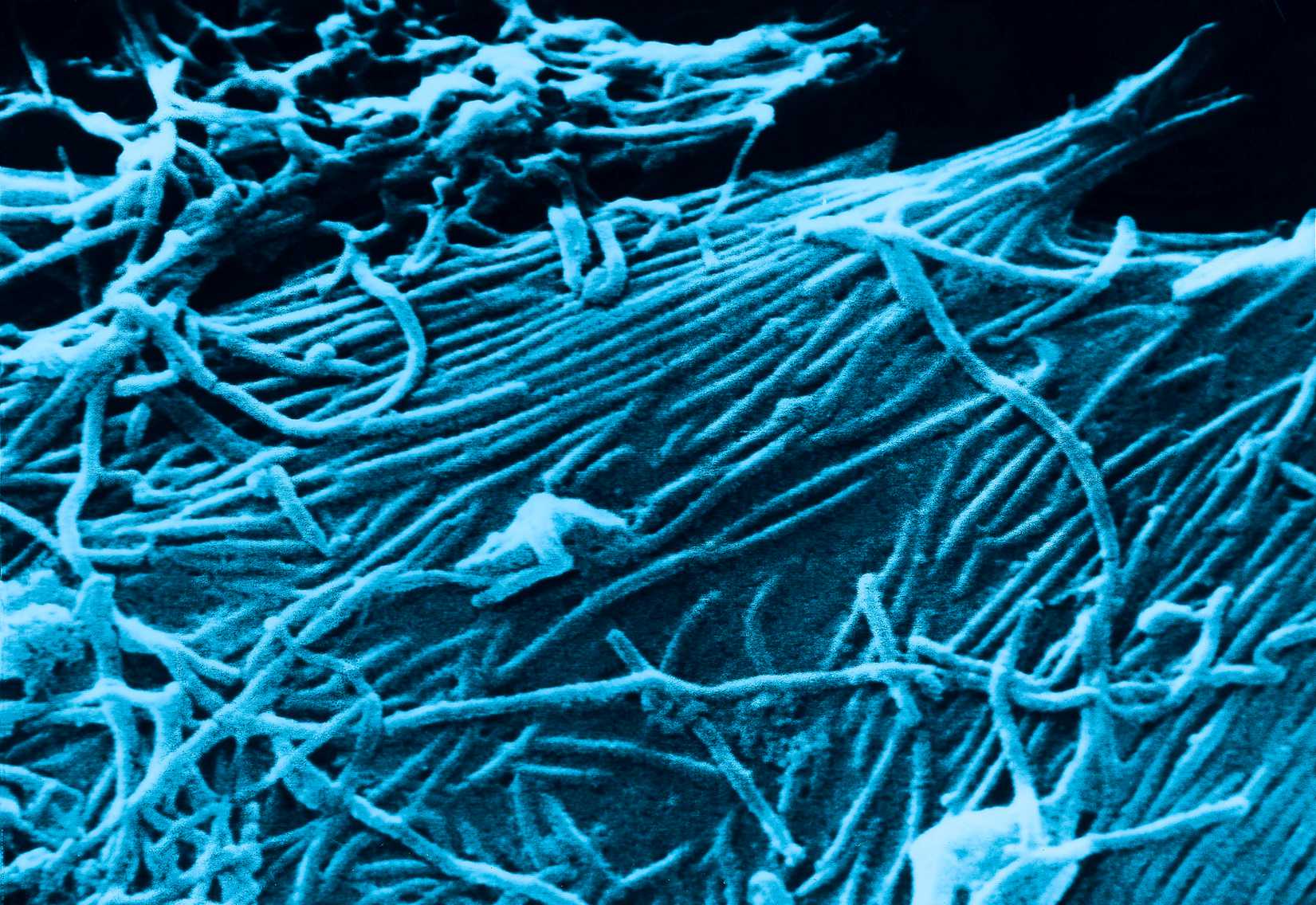 This scanning electron micrograph, SEM, depicts a number of Ebola virions.
