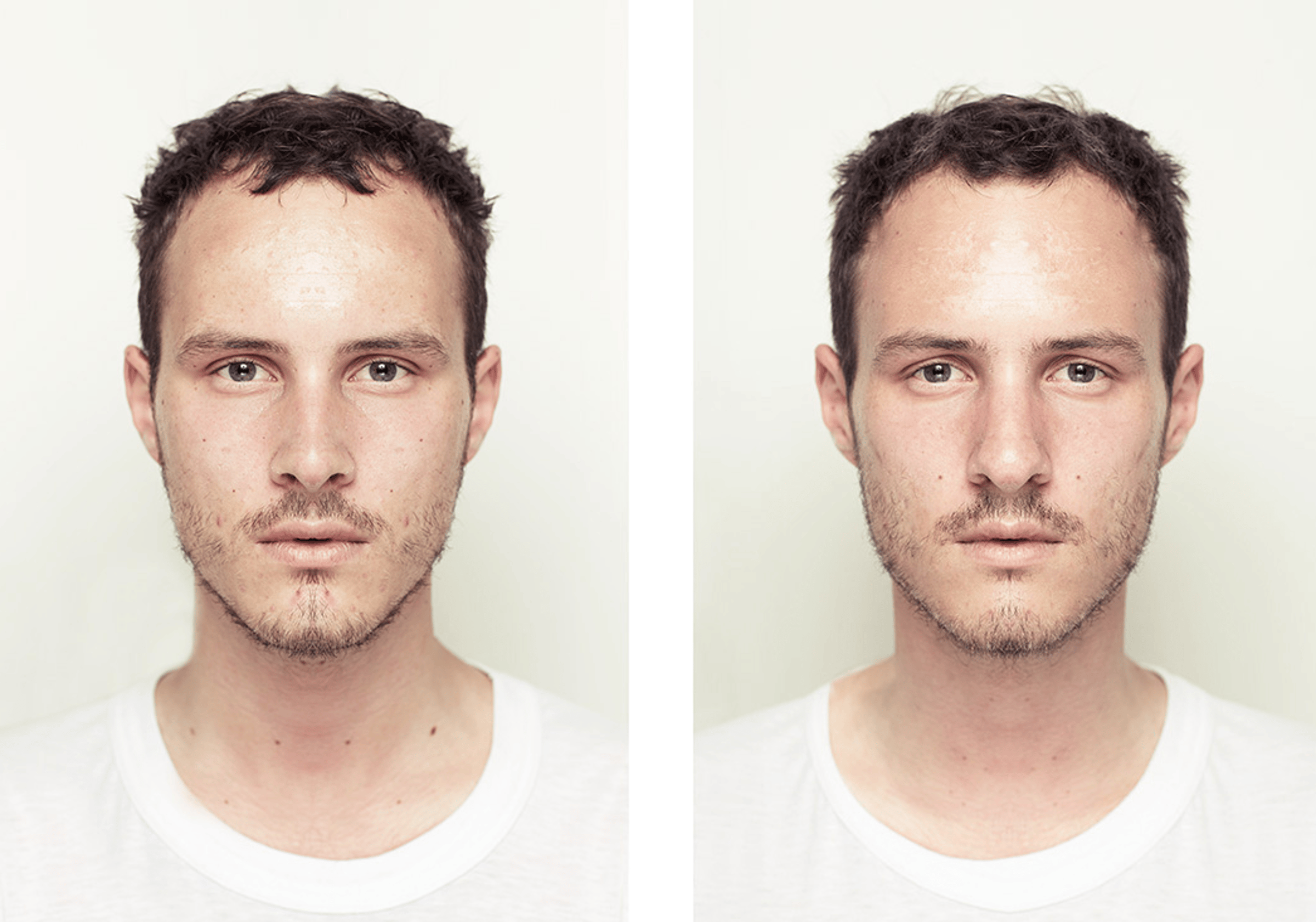 Symmetrical Face Example Photos: What Symmetrical Faces Really Look Like