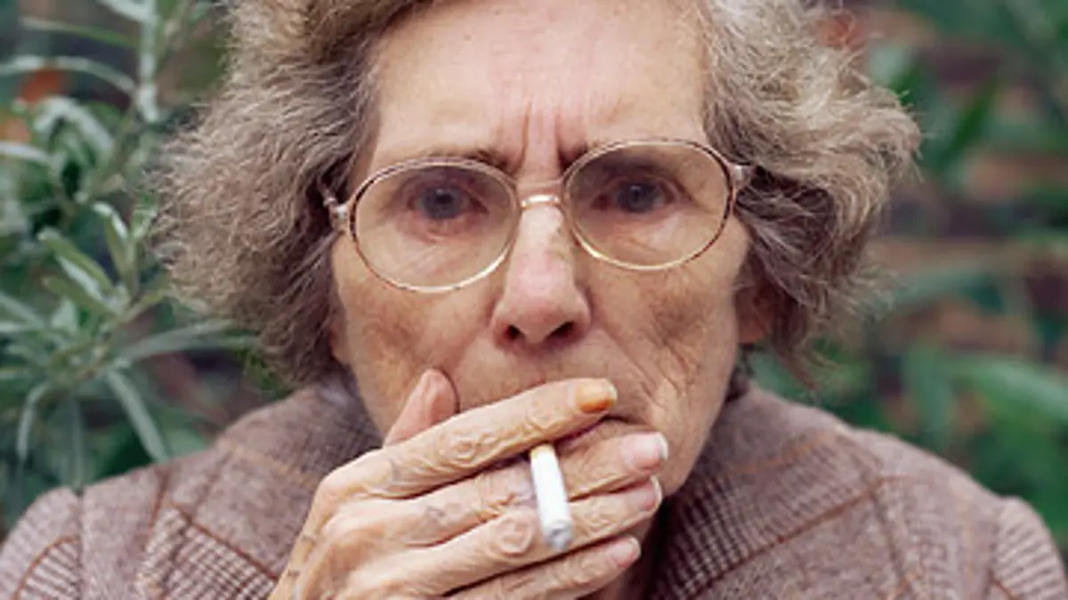 can tobacco stains on teeth be removed Stop smoking today, it only does harm. #dentist #smoke #stains #voorjou #foryou #foryourpage #voorjoupagina #viral #goviral