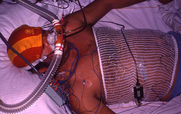 What to Do If You Have Sleep Apnea