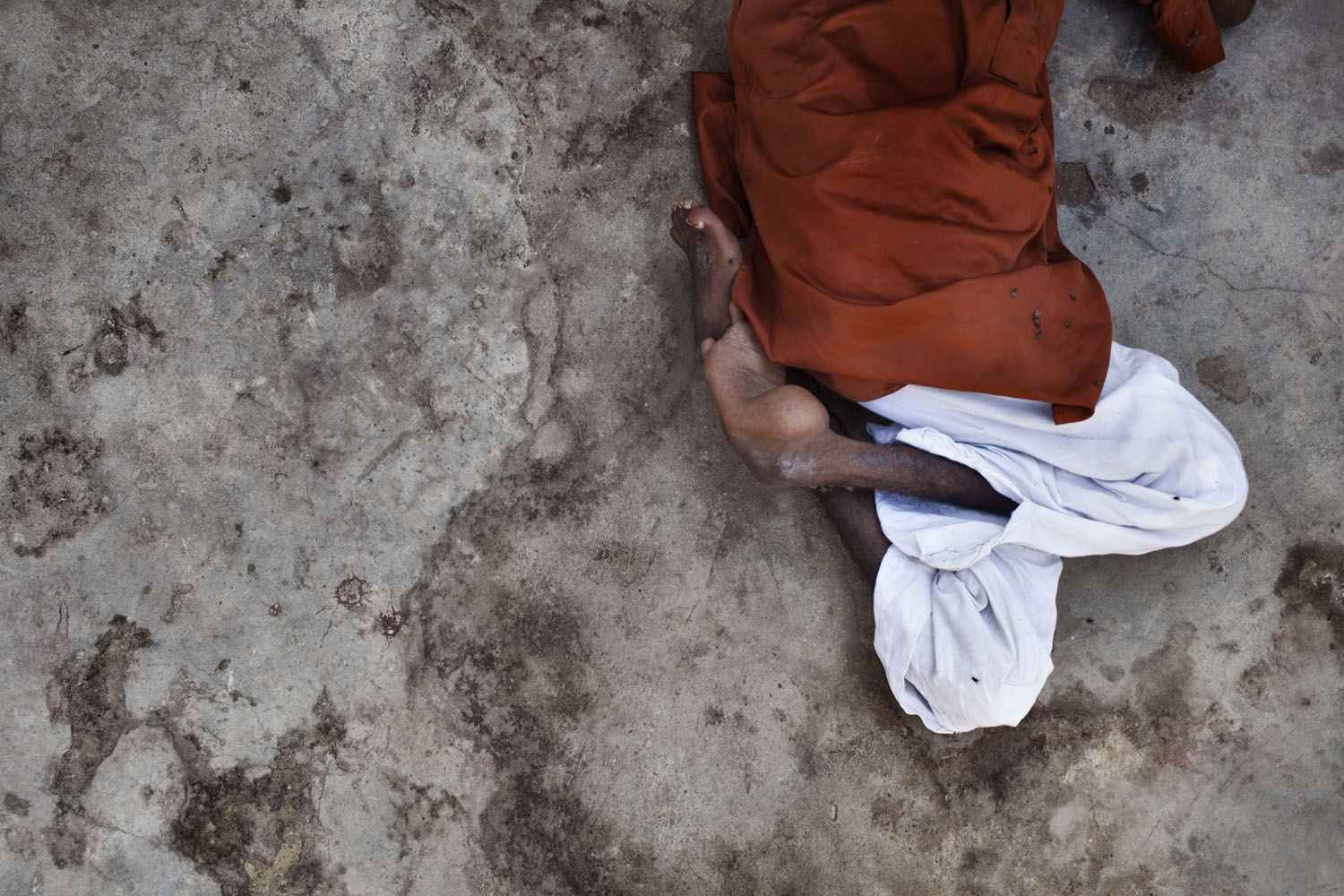 Image: Latif, son of Jam Pumhoom, got polio when he was 8 years old